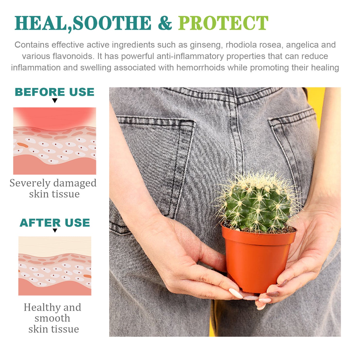 Hemorrhoids Capsule Relieves Perianal Itching