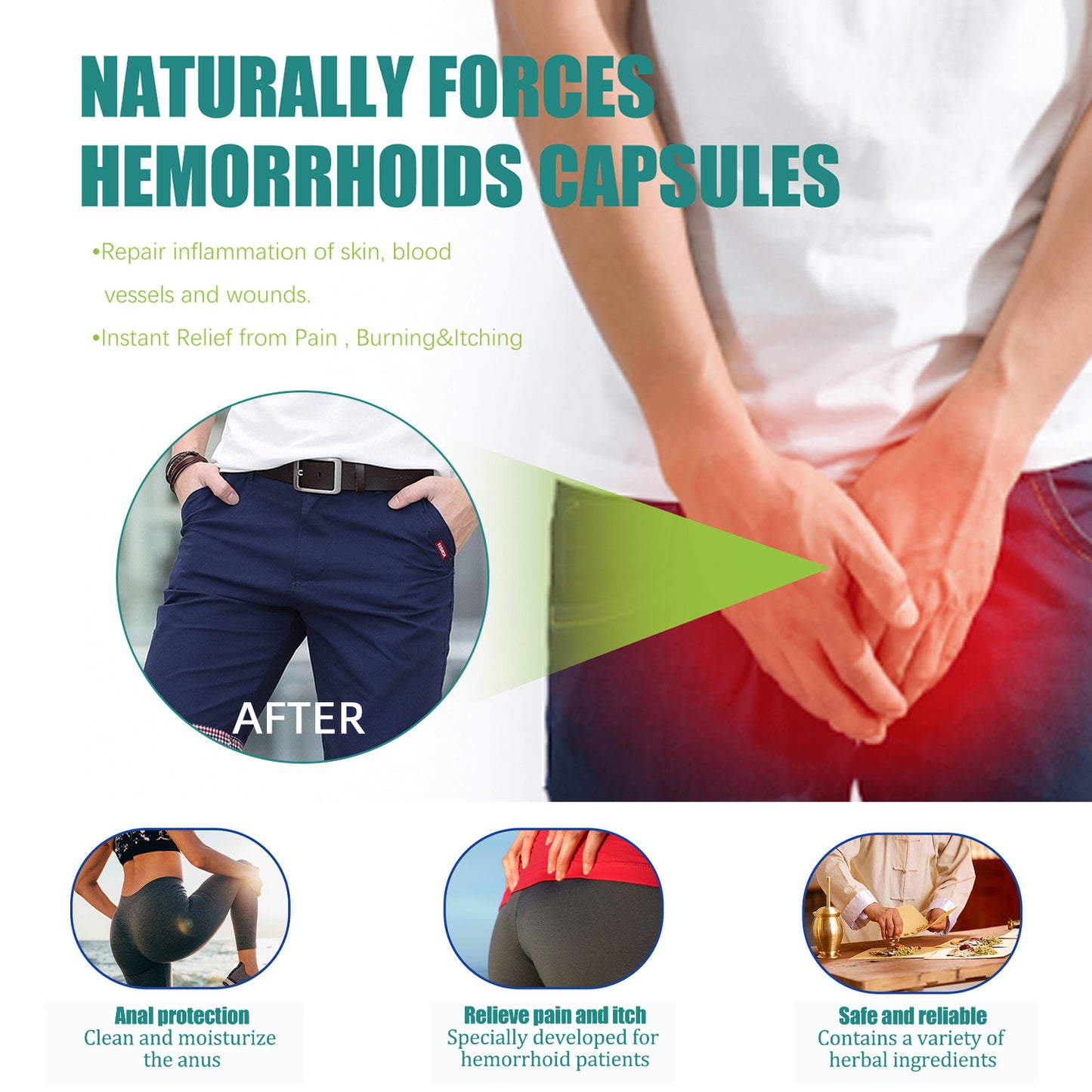 Hemorrhoids Capsule Relieves Perianal Itching